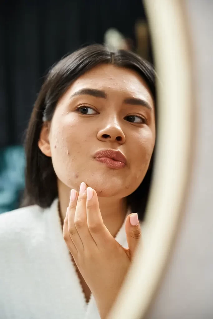 Understanding Pimples